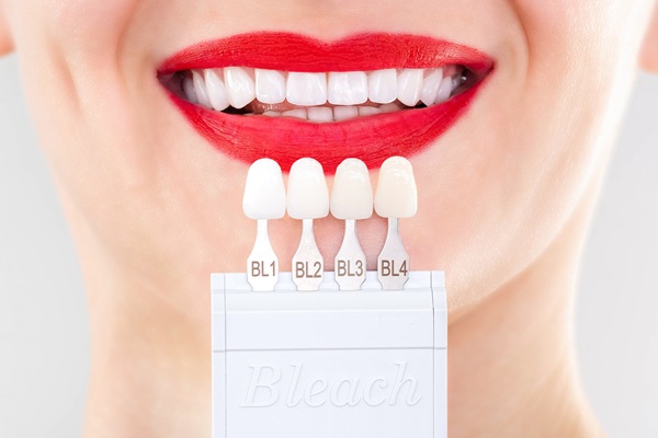 When Would A Dentist Recommend Dental Veneers?